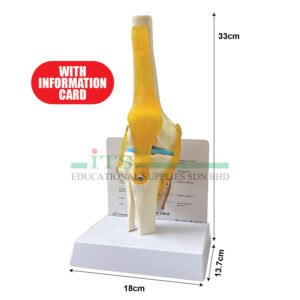 model sendi lutut manusia