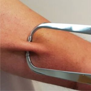 skinfold caliper (body fat measuring tool)