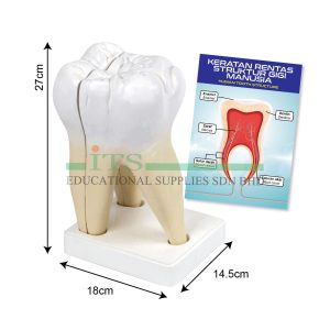 model struktur gigi manusia